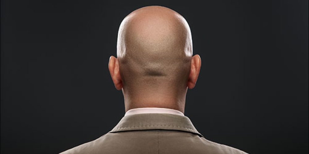 Bald Man
